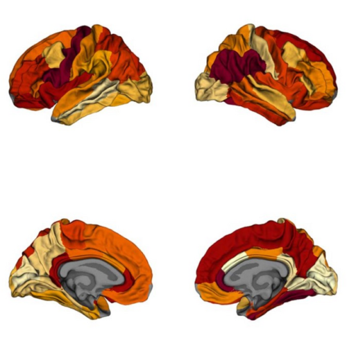 Controlling excess weight could lead to improved health outcomes, slow cognitive decline