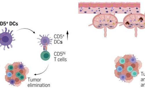 Cancer patients who don’t respond to immunotherapy may lack crucial immune cells