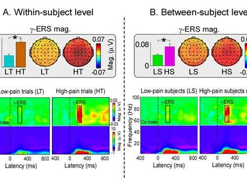 Pain-related gamma-band oscillations reflect pain perception