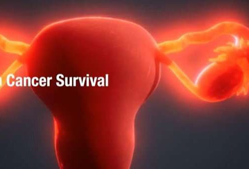 Simple low-dose aspirin may boost ovarian cancer survival