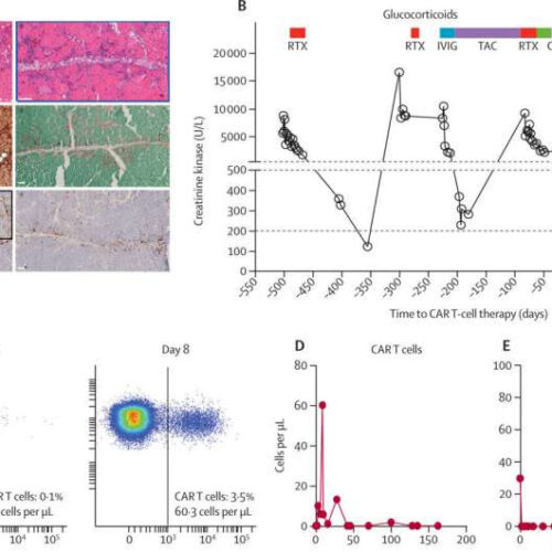 Testing their strength: CAR T-cells combat muscle inflammation