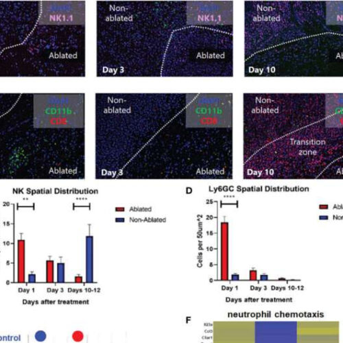 How sound waves trigger immune responses to cancer in mice