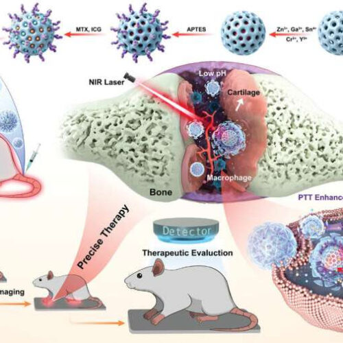 Autofluorescence-free, imaging-guided precision therapy for rheumatoid arthritis