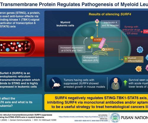 Pusan National University researchers uncover novel gene that regulates leukemia development and progression