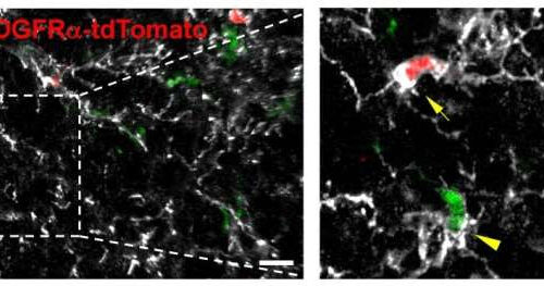 Researchers identify new cell source for microgliosis in neurodegenerative diseases