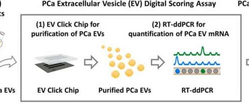 Noninvasive test can detect even trace elements of prostate cancer