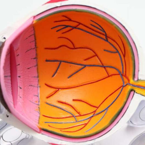 AI finds twisting of eye vessels could cause high blood pressure and heart disease