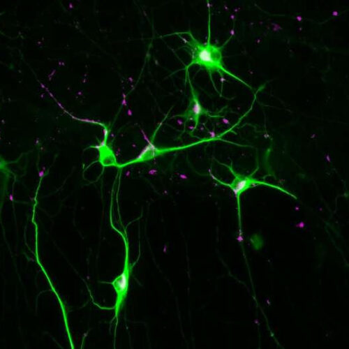 Potential therapeutic target for schizophrenia identified