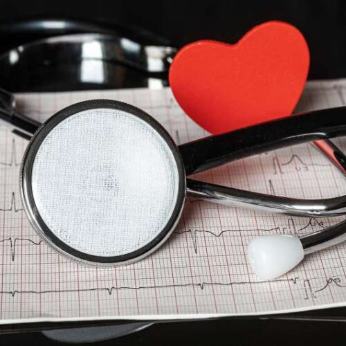 Tips for recognizing, living with and preventing atrial fibrillation (AFib)