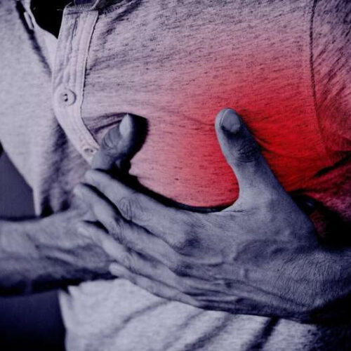 When chest pain isn’t a heart attack