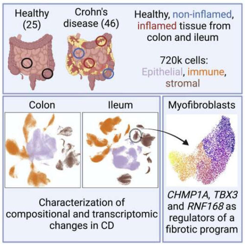 Single-cell analysis of Crohn’s disease reveals a detailed picture of inflammation in the gut