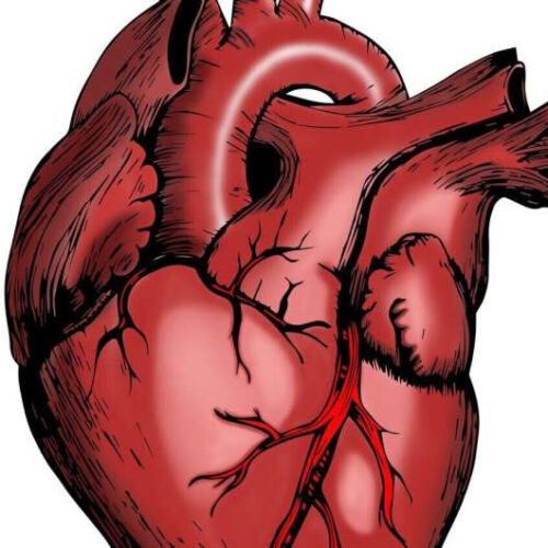 COVID toll realized: CVD deaths take big jump, especially among certain populations