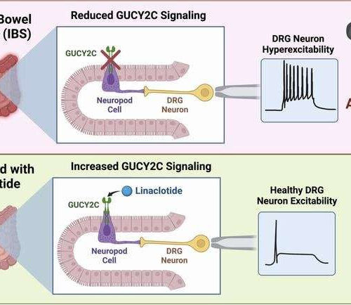 New drug target to treat pain from visceral organs