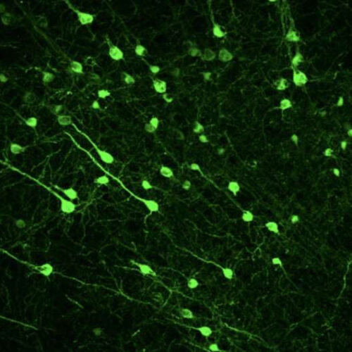 A neural substrate that may modulate sex differences in motivation