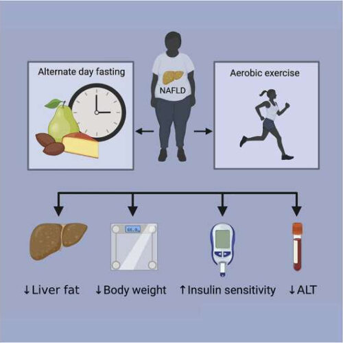 Alternate-day fasting could be a good option for patients with fatty liver disease