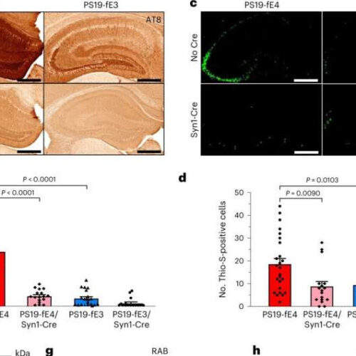 Impact of key Alzheimer’s protein depends on type of brain cell in which it is produced