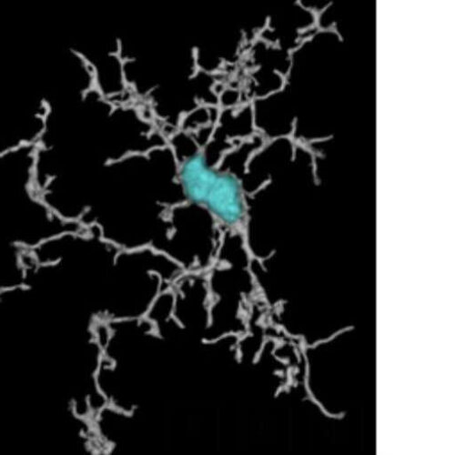 A TREM2 activating antibody with a transport vehicle that could boost the metabolism and function of brain microglia