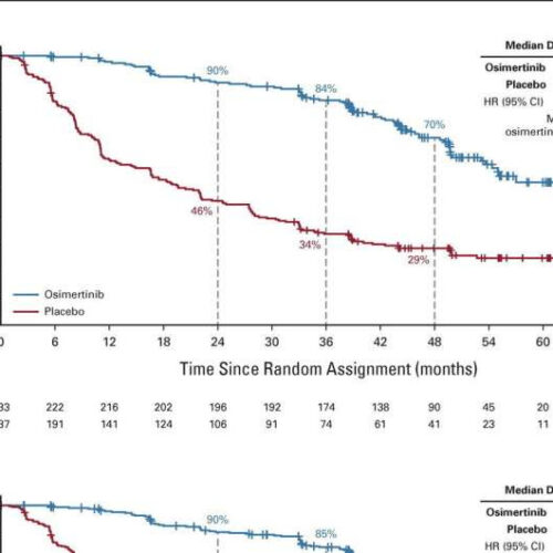 Clinical trial shows significant disease-free survival for patients diagnosed with non-small cell lung cancer