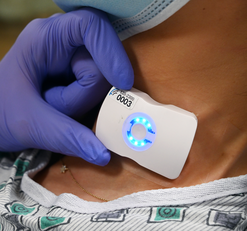 El Camino Health is first in the world to adopt FloPatch advanced ultrasound technology for sepsis management