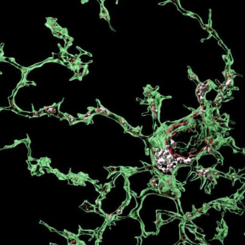 Perivascular cells could induce microglial malfunction associated with Alzheimer’s disease