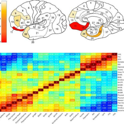 Dedicated protocol of hyperbaric oxygen therapy found to be more effective for fibromyalgia caused by head injury