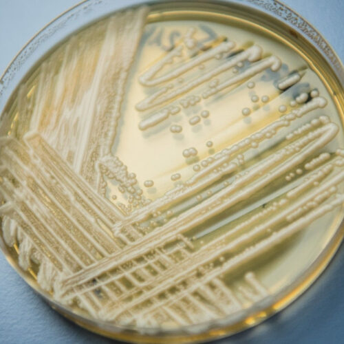 Fact: A drug-resistant fungus is spreading in US hospitals