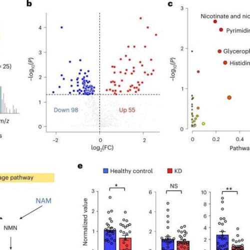 Scientists uncover protective role of NAD maintenance in kidney disease