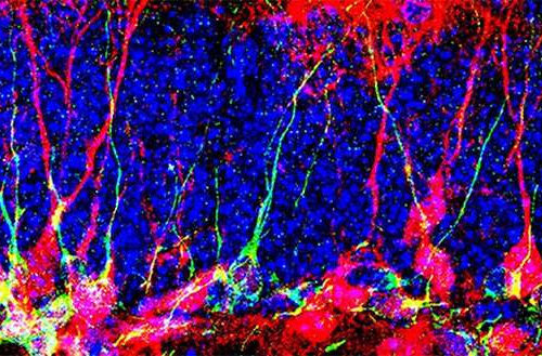 How to generate new neurons in the brain