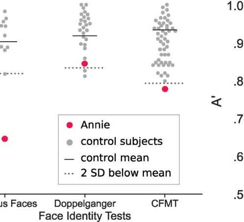 COVID-19 can cause ‘face blindness,’ according to new study