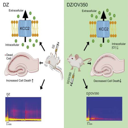 Potential treatment target for drug-resistant epilepsy identified