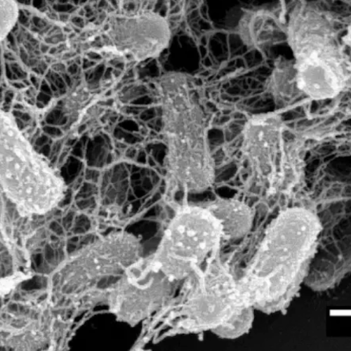 Bacteria-activated, self-assembling “nanonets” trap and kill superbugs