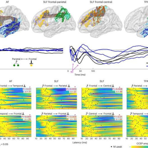 Mental decline comes later than previously thought, finds study