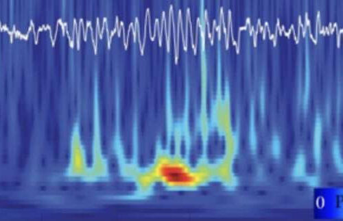 Studying brain oscillations to understand what makes a memory stick