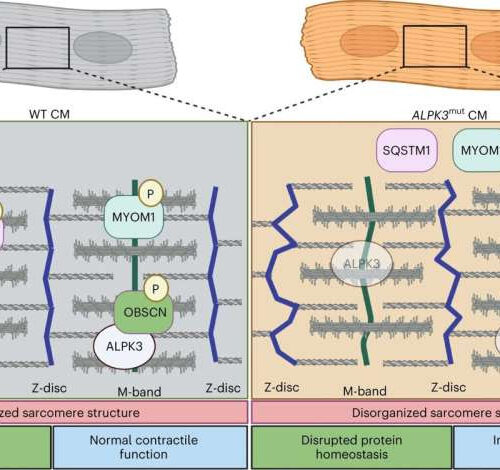 Researchers uncover how gene that increases heart disease risk works