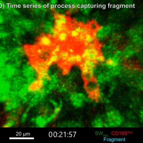 Specialized garbage disposal cell, implicated in autoimmune disease, tracked for the first time