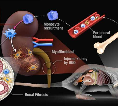 Researchers identify two enzymes involved in macrophage polarization in kidney fibrosis