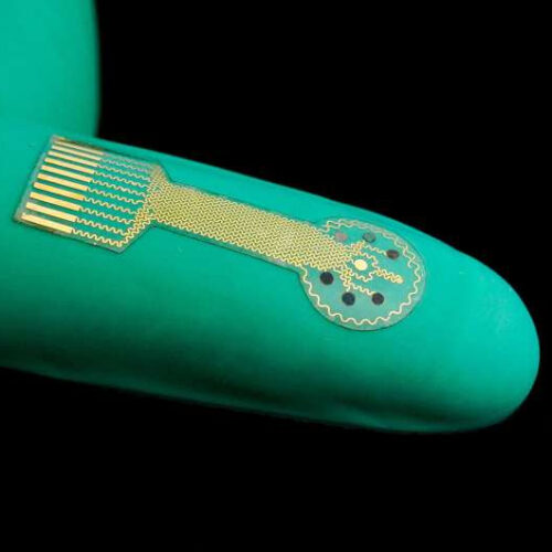 Smart’ bandages monitor wounds and provide targeted treatment