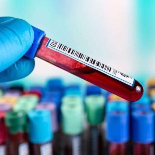 CDC updates recommendations for hepatitis B virus screening