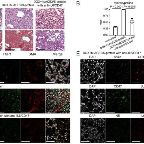 A possible way to prevent or treat lung damage associated with long COVID