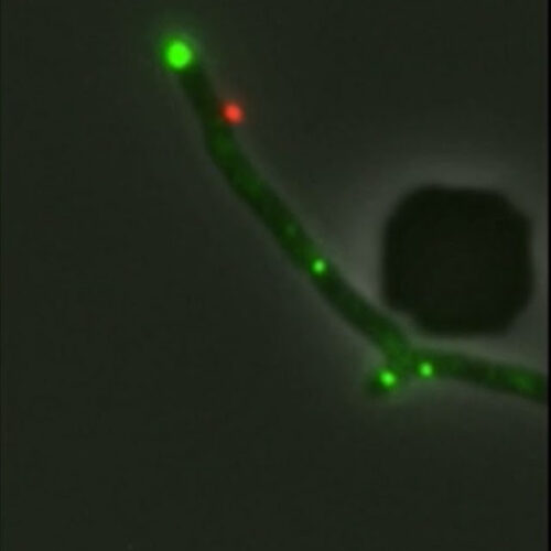 A Pitt lab shows phage attacks in new light