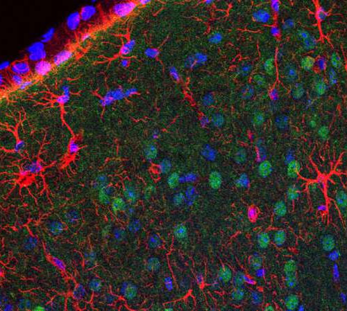 Sex-specific differences seen in response to reduced insulin activity