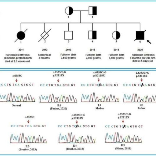 Novel rare skin mutation gene identified by whole exome sequencing