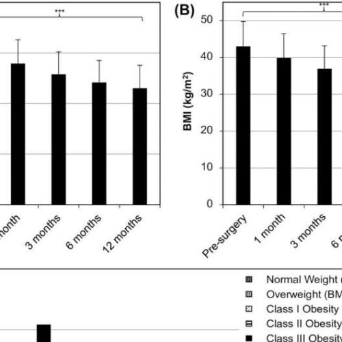 Weight loss surgery showing promising results for type 2 diabetes