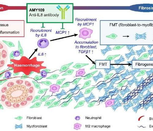 Long-acting recycling antibody targets endometriosis