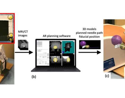 Free-hand, real-time needle guidance for prostate cancer diagnosis with augmented reality