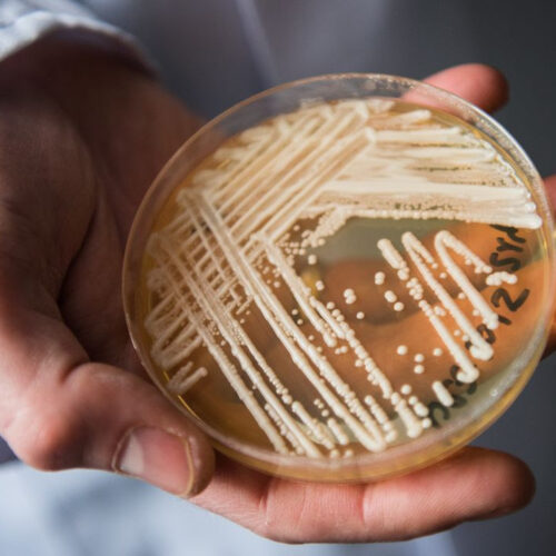 An emerging fungal threat spread at an alarming rate in US health care facilities, study says