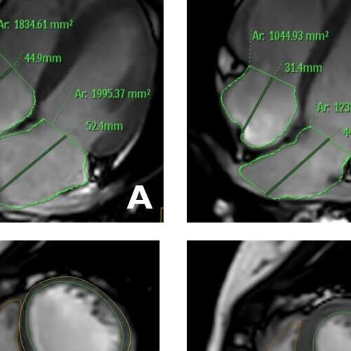 Imaging the adolescent heart provides ‘normal’ reference values for clinical practice