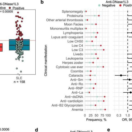 Researchers identify the origin of subset of autoantibodies that worsen lupus