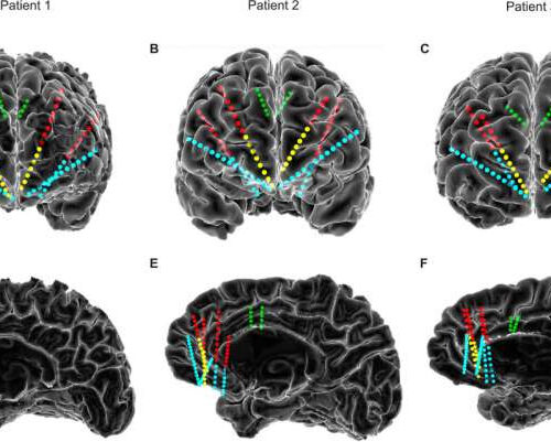 Progress in unlocking the brain’s ‘code’ for depression