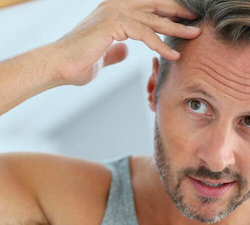 Does Diabetes Cause Hair Loss?